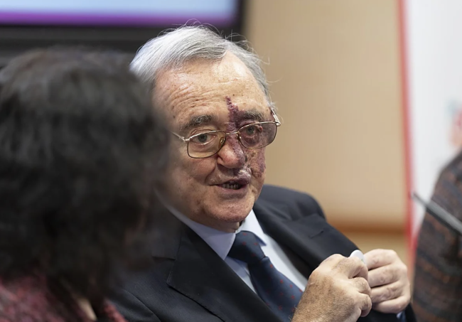 Rozpoczęta kampania fundraisingowa na rzecz przełomu hiszpańskiego w badaniach nad rakiem trzustki