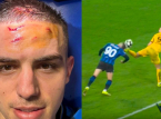 Nikola Krstović z Atalanty pokazuje czoło po dramatycznym rzucie karnym w ostatniej minucie przeciwko BVB
